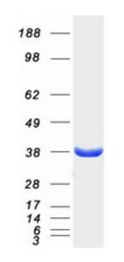 SDS-PAGE (MDH2-2010H).jpg